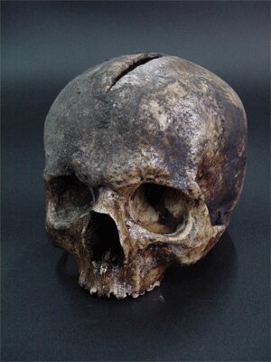 Cráneo humano de atrezzo